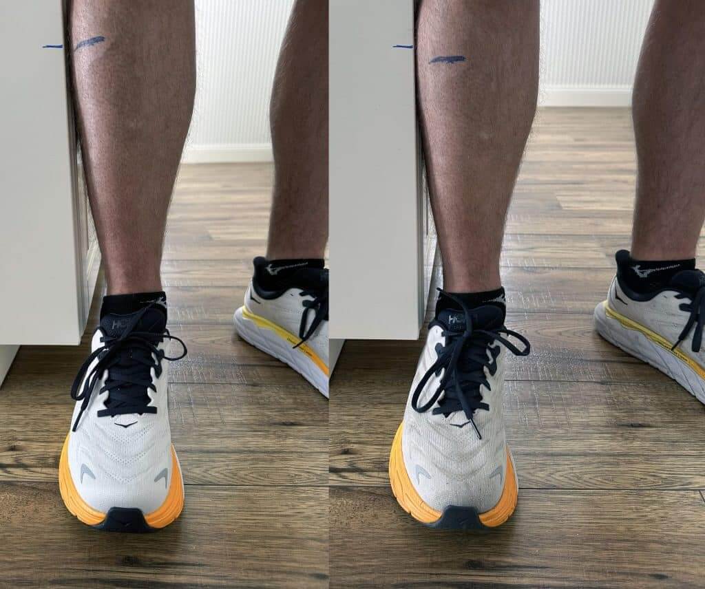 midfoot shrinkage